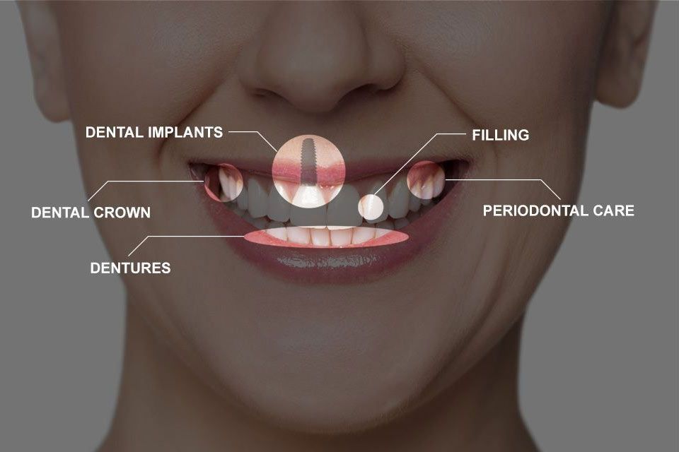 full mouth construction treatments